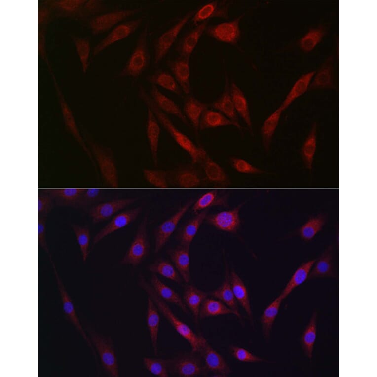 Immunofluorescence - Anti-FGF 23 Antibody (A9796) - Antibodies.com