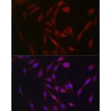 Immunofluorescence - Anti-FGF 23 Antibody (A9796) - Antibodies.com