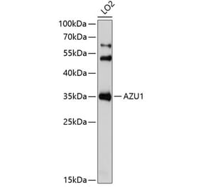 Western Blot - Anti-Azurocidin Antibody (A9797) - Antibodies.com