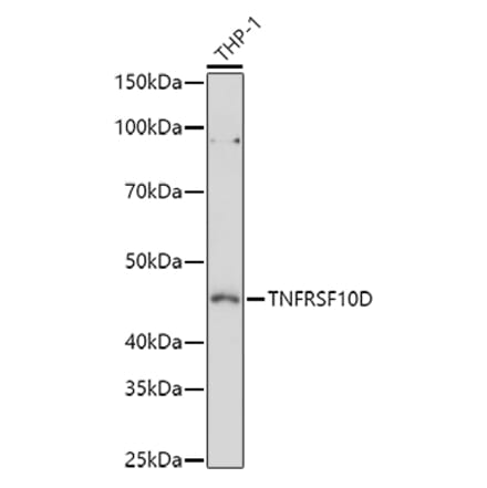 Western Blot - Anti-DcR2 Antibody (A9798) - Antibodies.com