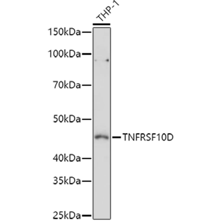Western Blot - Anti-DcR2 Antibody (A9798) - Antibodies.com