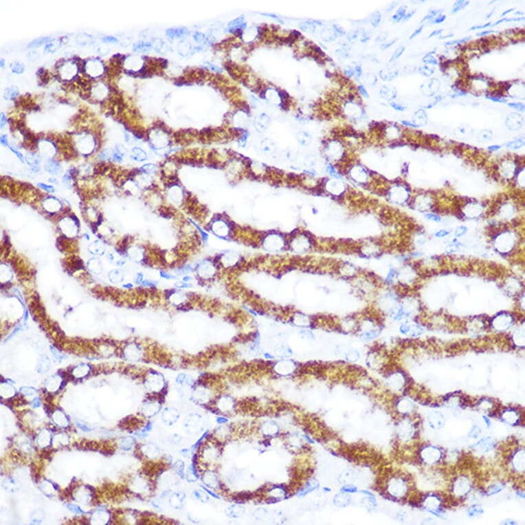 Immunohistochemistry - Anti-DcR2 Antibody (A9798) - Antibodies.com