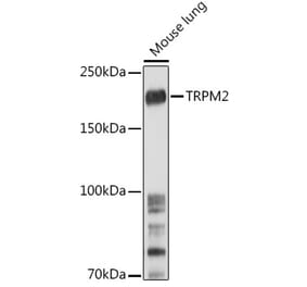 Western Blot - Anti-TRPM2 Antibody (A9799) - Antibodies.com