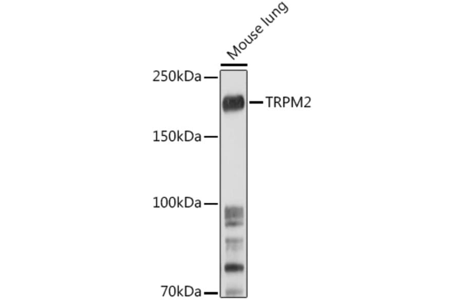 Western Blot - Anti-TRPM2 Antibody (A9799) - Antibodies.com