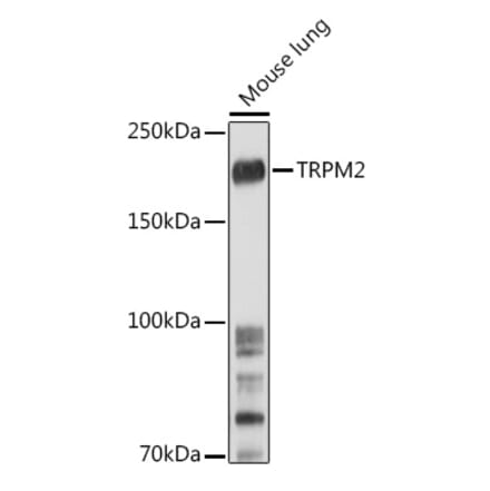 Western Blot - Anti-TRPM2 Antibody (A9799) - Antibodies.com