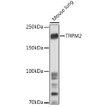 Western Blot - Anti-TRPM2 Antibody (A9799) - Antibodies.com