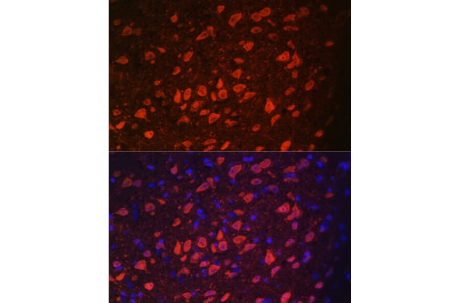 Immunofluorescence - Anti-TRPM2 Antibody (A9799) - Antibodies.com