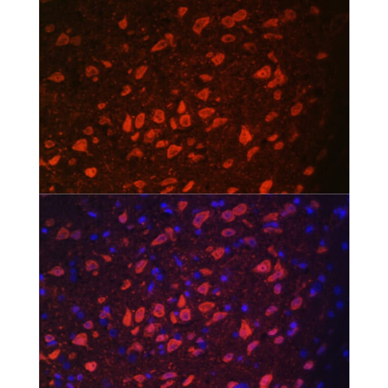 Immunofluorescence - Anti-TRPM2 Antibody (A9799) - Antibodies.com