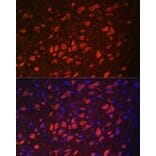 Immunofluorescence - Anti-TRPM2 Antibody (A9799) - Antibodies.com