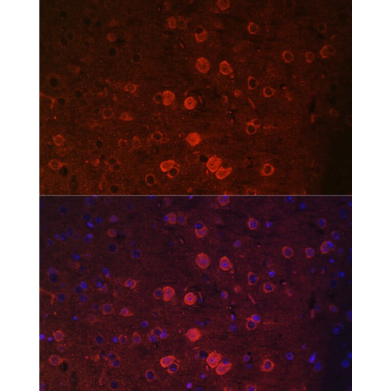 Immunofluorescence - Anti-TRPM2 Antibody (A9799) - Antibodies.com