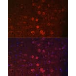 Immunofluorescence - Anti-TRPM2 Antibody (A9799) - Antibodies.com