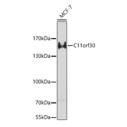 Western Blot - Anti-EMSY Antibody (A9800) - Antibodies.com