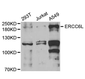 Western Blot - Anti-PICH Antibody (A9801) - Antibodies.com
