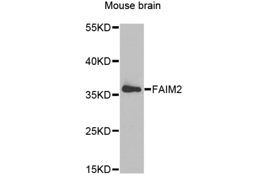 Western Blot - Anti-FAIM2 Antibody (A6152) - Antibodies.com