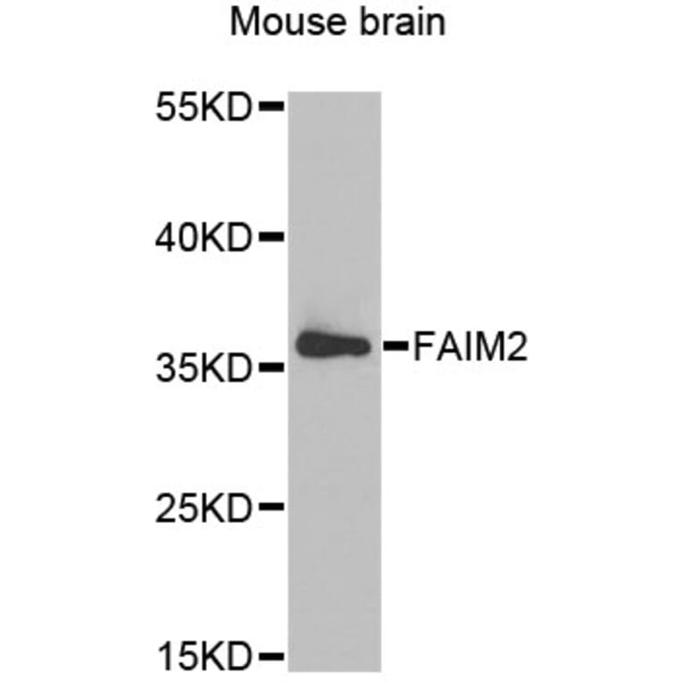 Western Blot - Anti-FAIM2 Antibody (A6152) - Antibodies.com