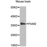 Western Blot - Anti-FAIM2 Antibody (A6152) - Antibodies.com