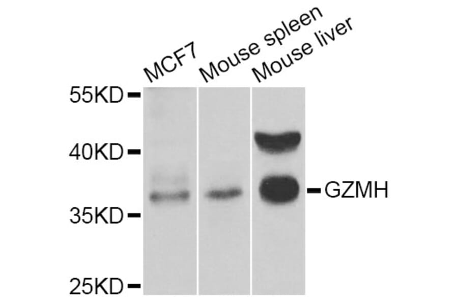 Western Blot - Anti-GZMH Antibody (A6154) - Antibodies.com