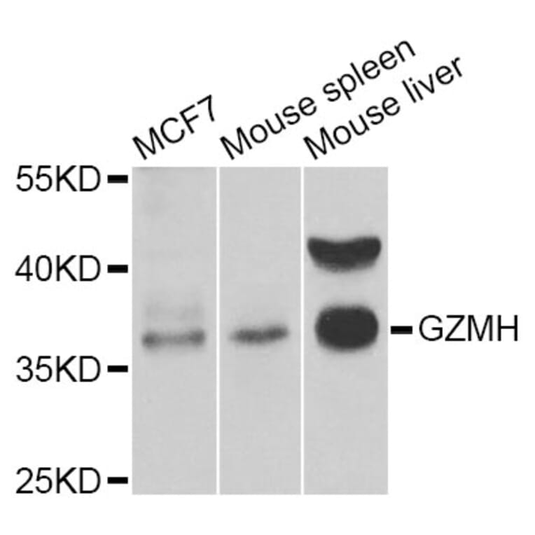 Western Blot - Anti-GZMH Antibody (A6154) - Antibodies.com