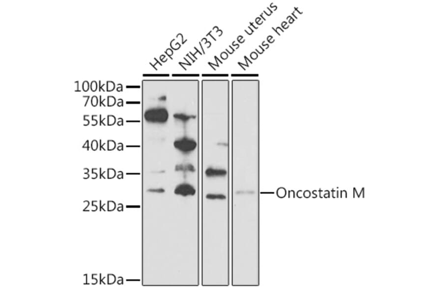 Western Blot - Anti-Oncostatin M/OSM Antibody (A9805) - Antibodies.com