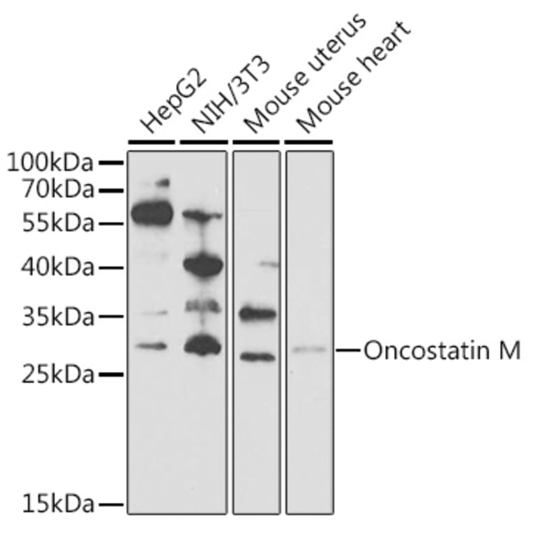 Western Blot - Anti-Oncostatin M/OSM Antibody (A9805) - Antibodies.com