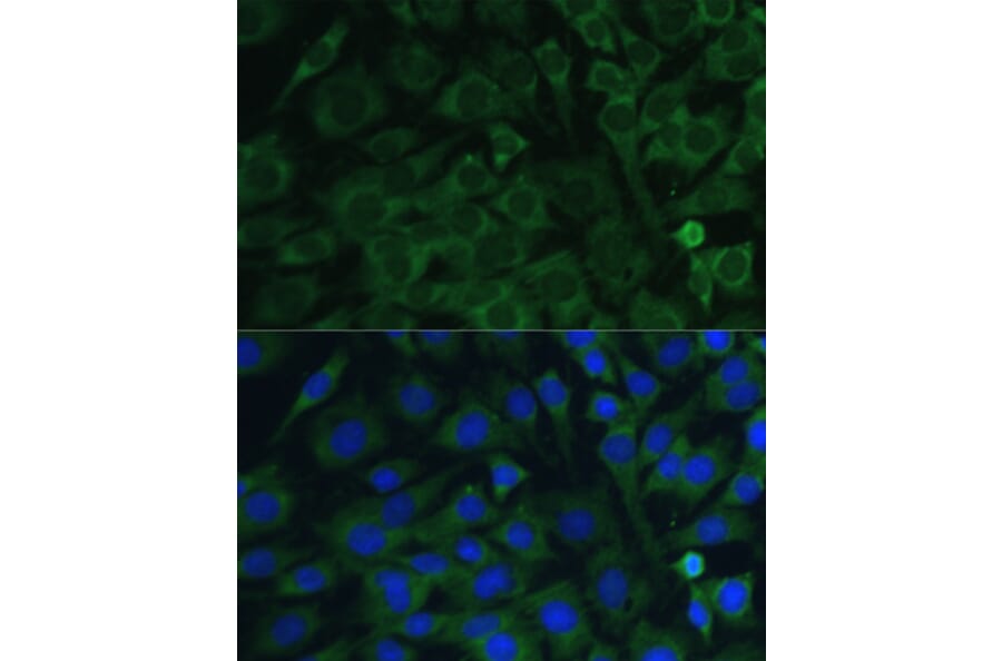 Immunofluorescence - Anti-Oncostatin M/OSM Antibody (A9805) - Antibodies.com
