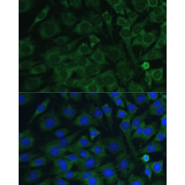 Immunofluorescence - Anti-Oncostatin M/OSM Antibody (A9805) - Antibodies.com