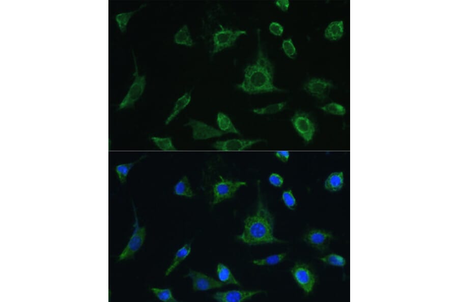 Immunofluorescence - Anti-Oncostatin M/OSM Antibody (A9805) - Antibodies.com