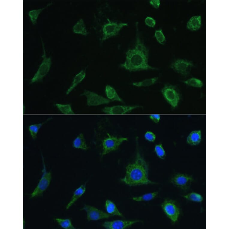 Immunofluorescence - Anti-Oncostatin M/OSM Antibody (A9805) - Antibodies.com