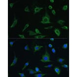 Immunofluorescence - Anti-Oncostatin M/OSM Antibody (A9805) - Antibodies.com