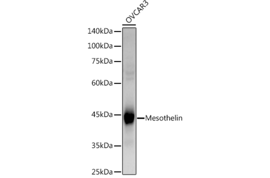 Western Blot - Anti-Mesothelin Antibody (A9809) - Antibodies.com