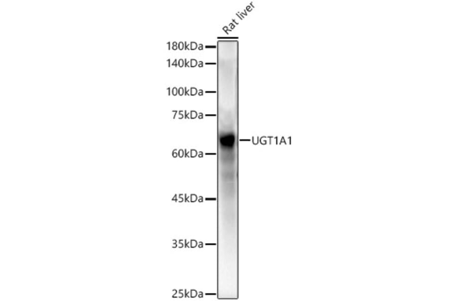 Western Blot - Anti-UGT1A1 Antibody (A9810) - Antibodies.com