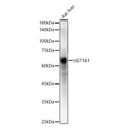 Western Blot - Anti-UGT1A1 Antibody (A9810) - Antibodies.com