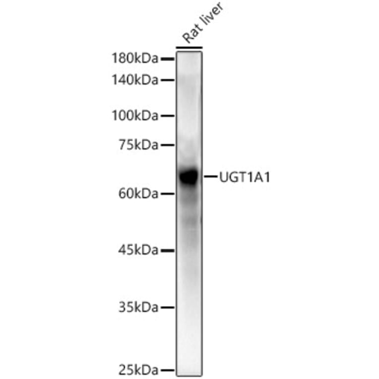 Western Blot - Anti-UGT1A1 Antibody (A9810) - Antibodies.com