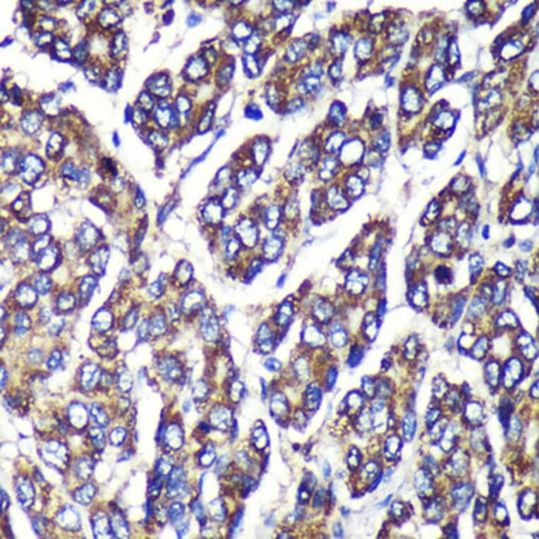 Immunohistochemistry - Anti-UGT1A1 Antibody (A9810) - Antibodies.com