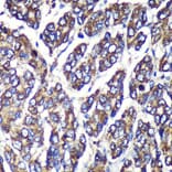 Immunohistochemistry - Anti-UGT1A1 Antibody (A9810) - Antibodies.com