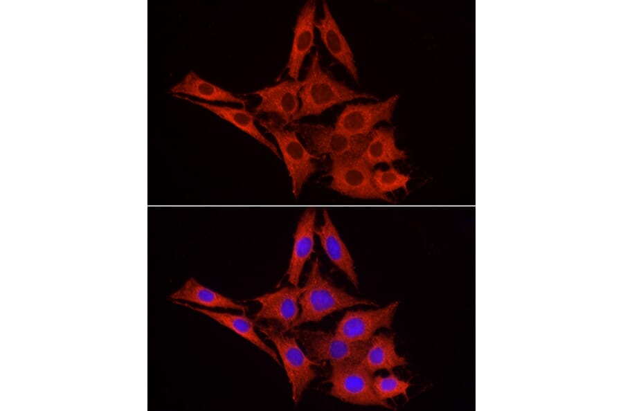 Immunofluorescence - Anti-UGT1A1 Antibody (A9810) - Antibodies.com