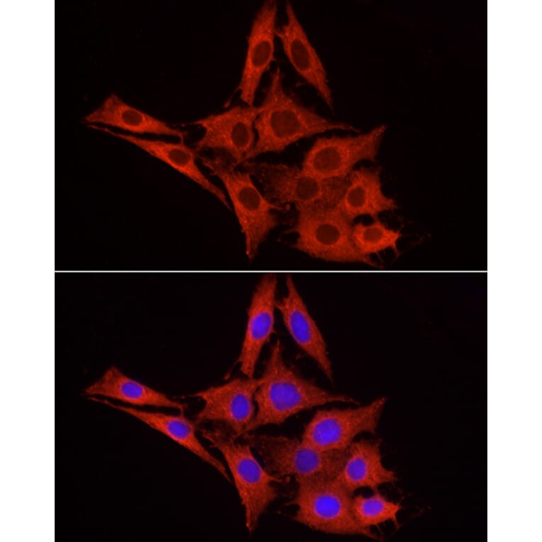 Immunofluorescence - Anti-UGT1A1 Antibody (A9810) - Antibodies.com