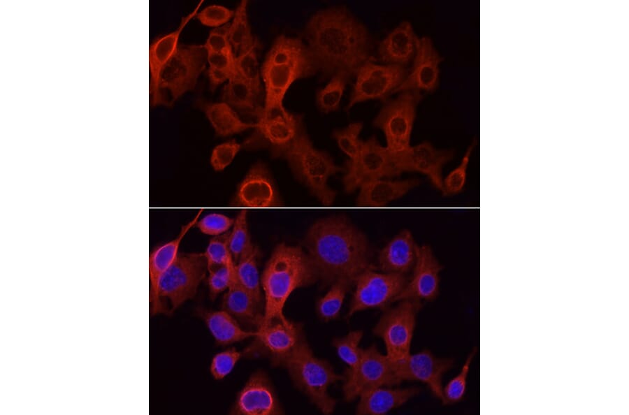 Immunofluorescence - Anti-UGT1A1 Antibody (A9810) - Antibodies.com
