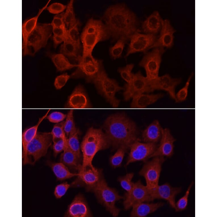 Immunofluorescence - Anti-UGT1A1 Antibody (A9810) - Antibodies.com