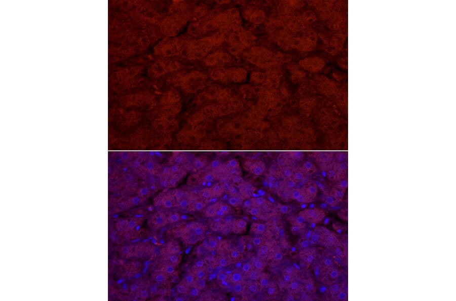 Immunofluorescence - Anti-UGT1A1 Antibody (A9810) - Antibodies.com