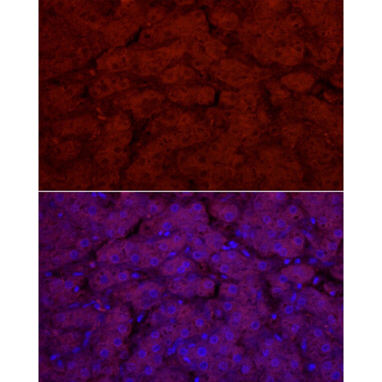 Immunofluorescence - Anti-UGT1A1 Antibody (A9810) - Antibodies.com