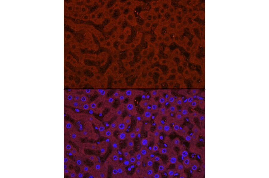 Immunofluorescence - Anti-UGT1A1 Antibody (A9810) - Antibodies.com