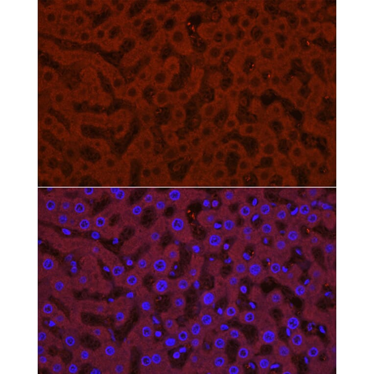 Immunofluorescence - Anti-UGT1A1 Antibody (A9810) - Antibodies.com