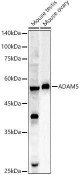 Western blot analysis of extracts of HeLa cells, using Anti-ADAM5 Antibody (A6196).
Secondary antibody: Goat Anti-Rabbit IgG (H+L) (HRP) (AS014) at 1:10,000 dilution.
Lysates / proteins: 25µg per lane.
Blocking buffer: 3% non-fat dry milk in TBST.