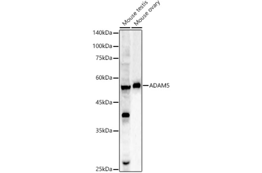 Western Blot - Anti-ADAM5 Antibody (A9813) - Antibodies.com