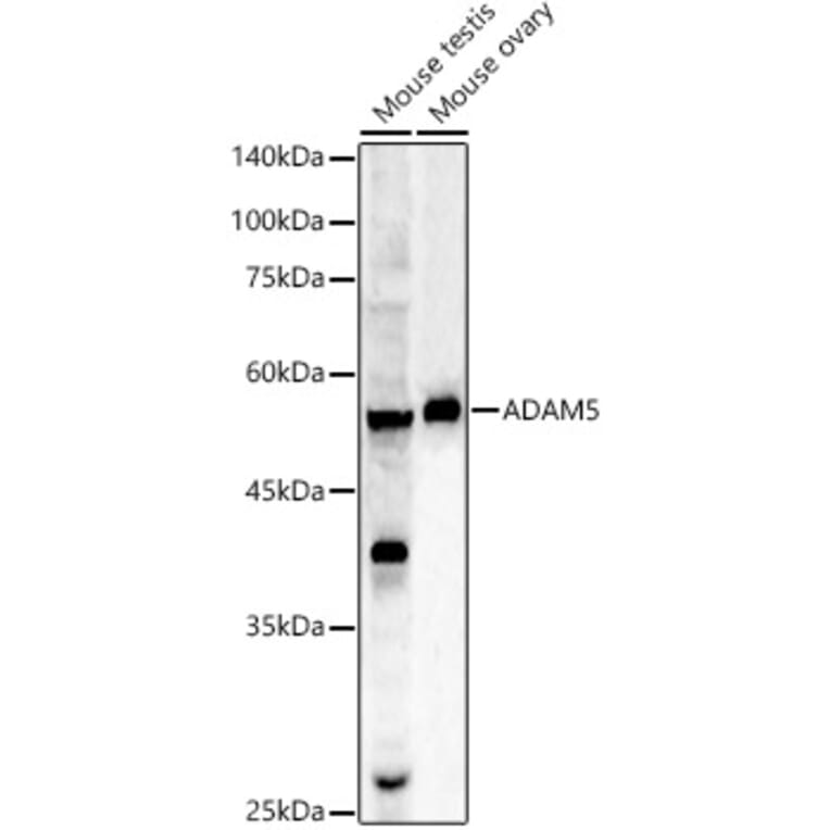 Western Blot - Anti-ADAM5 Antibody (A9813) - Antibodies.com