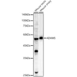 Western Blot - Anti-ADAM5 Antibody (A9813) - Antibodies.com