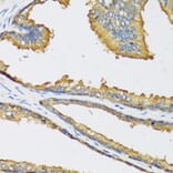 Immunohistochemistry - Anti-CXCL11 Antibody (A9814) - Antibodies.com