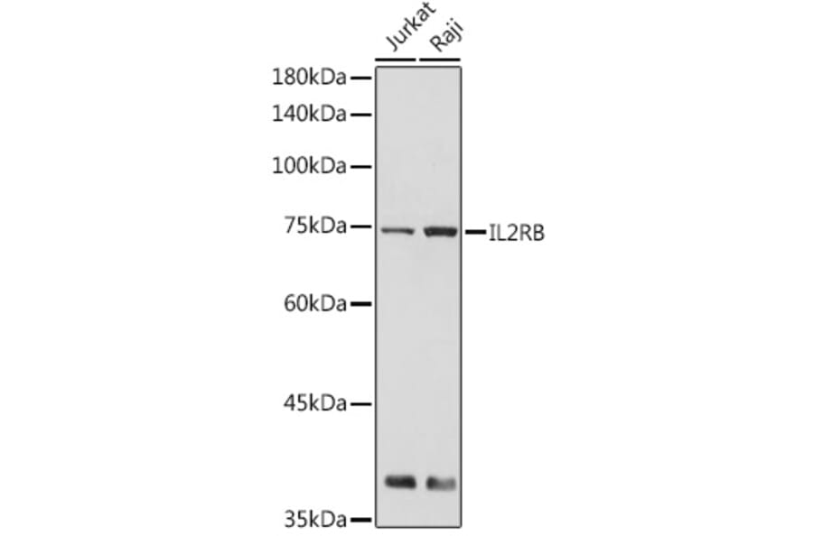Western Blot - Anti-IL2 Receptor beta/p75 Antibody (A9815) - Antibodies.com