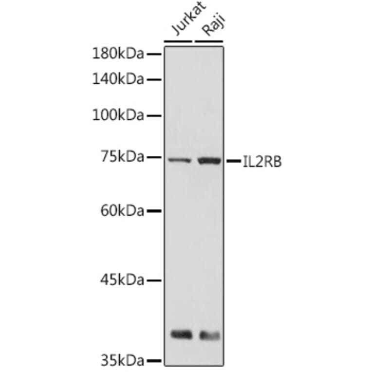 Western Blot - Anti-IL2 Receptor beta/p75 Antibody (A9815) - Antibodies.com